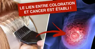 Des chercheurs établissent le lien entre coloration des cheveux et cancer !