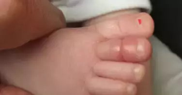 Cheveu étrangleur : cette maman sauve son bébé de justesse !
